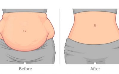 Top Body Contouring 101: What to Expect from Your First Session