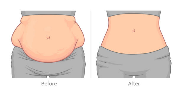 Top Body Contouring 101: What to Expect from Your First Session